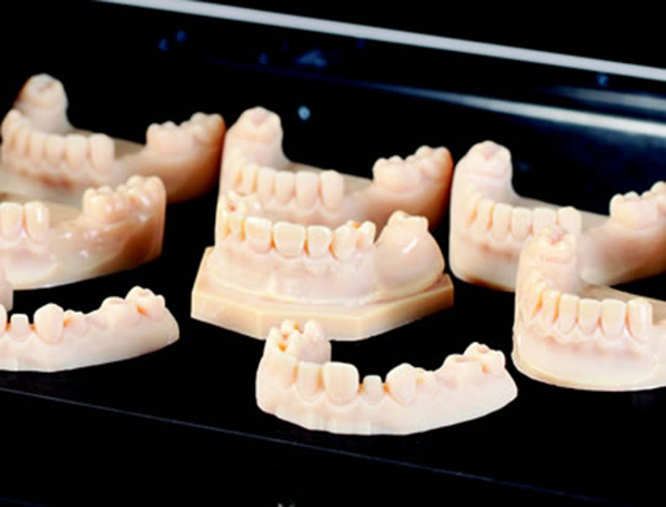 Có thể tạo ra răng giả bằng phương pháp in 3D