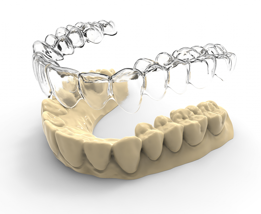 Khay niềng răng trong suốt in 3D